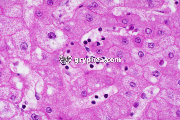 Cellules hépatiques x200 - gryphea.org